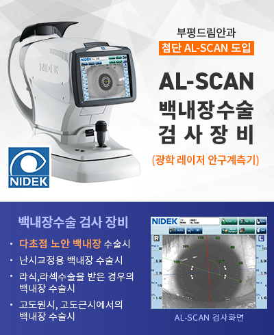al-scan